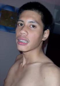 max-teeth ราชวงศ์ สุขเจริญ teeth